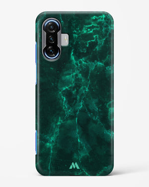 Olive Riddle Marble Hard Case Phone Cover (Xiaomi)