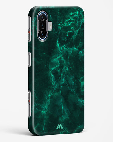 Olive Riddle Marble Hard Case Phone Cover-(Xiaomi)