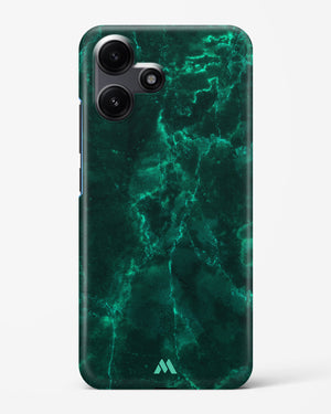 Olive Riddle Marble Hard Case Phone Cover (Xiaomi)