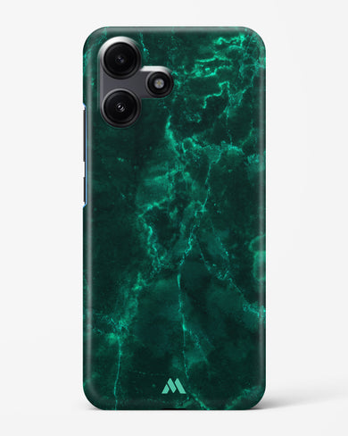 Olive Riddle Marble Hard Case Phone Cover (Xiaomi)