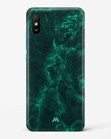 Olive Riddle Marble Hard Case Phone Cover (Xiaomi)