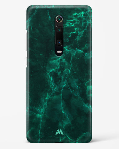 Olive Riddle Marble Hard Case Phone Cover (Xiaomi)