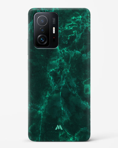 Olive Riddle Marble Hard Case Phone Cover (Xiaomi)