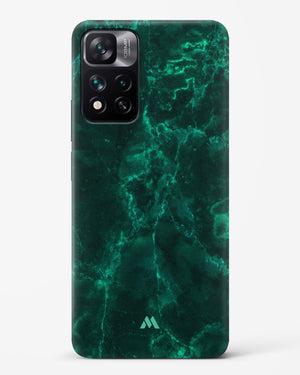 Olive Riddle Marble Hard Case Phone Cover (Xiaomi)