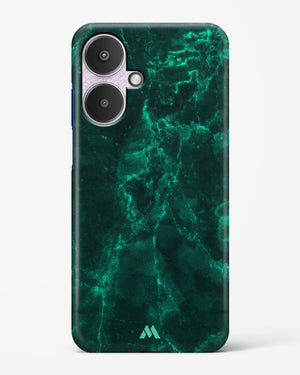 Olive Riddle Marble Hard Case Phone Cover (Xiaomi)
