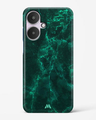 Olive Riddle Marble Hard Case Phone Cover (Xiaomi)