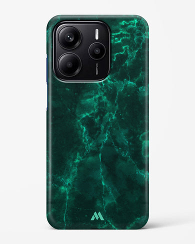 Olive Riddle Marble Hard Case Phone Cover (Xiaomi)