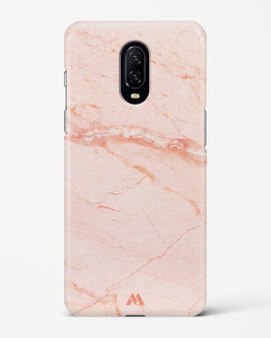 Rose Quartz on Marble Hard Case Phone Cover (OnePlus)