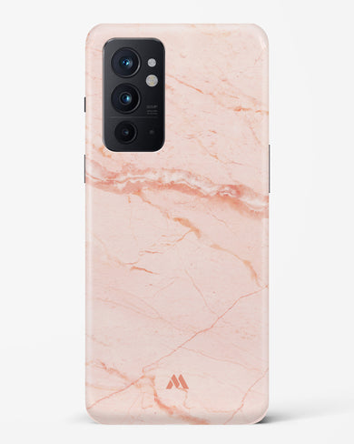 Rose Quartz on Marble Hard Case Phone Cover (OnePlus)