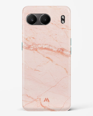 Rose Quartz on Marble Hard Case Phone Cover (OnePlus)