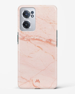 Rose Quartz on Marble Hard Case Phone Cover (OnePlus)