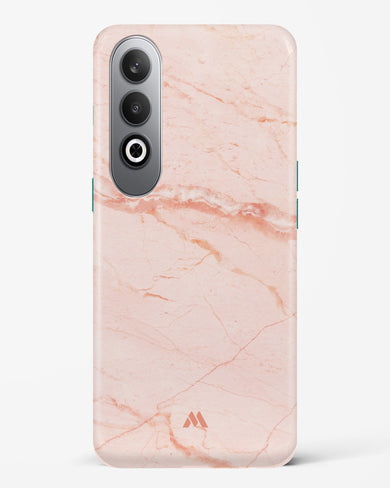 Rose Quartz on Marble Hard Case Phone Cover (OnePlus)