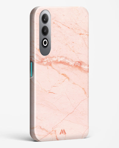 Rose Quartz on Marble Hard Case Phone Cover (OnePlus)