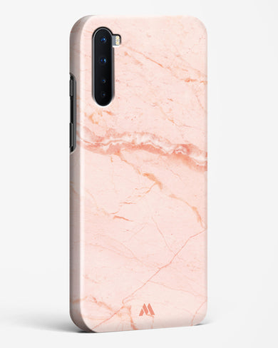 Rose Quartz on Marble Hard Case Phone Cover (OnePlus)