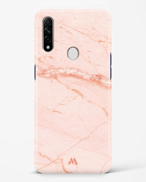 Rose Quartz on Marble Hard Case Phone Cover (Oppo)