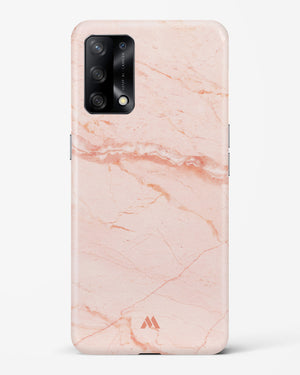 Rose Quartz on Marble Hard Case Phone Cover-(Oppo)