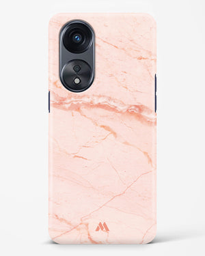 Rose Quartz on Marble Hard Case Phone Cover (Oppo)