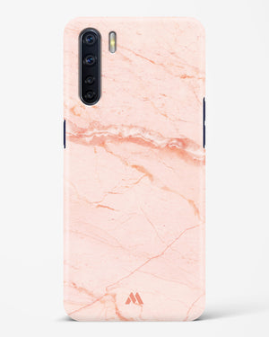 Rose Quartz on Marble Hard Case Phone Cover (Oppo)