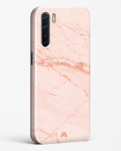 Rose Quartz on Marble Hard Case Phone Cover (Oppo)