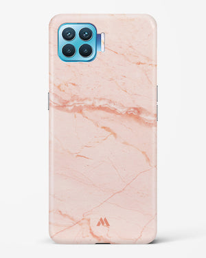 Rose Quartz on Marble Hard Case Phone Cover (Oppo)