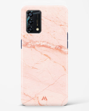 Rose Quartz on Marble Hard Case Phone Cover (Oppo)