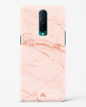 Rose Quartz on Marble Hard Case Phone Cover (Oppo)