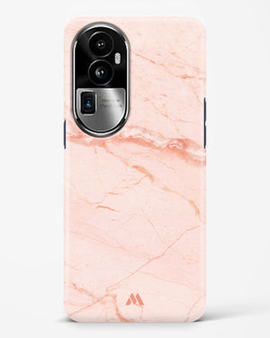 Rose Quartz on Marble Hard Case Phone Cover (Oppo)
