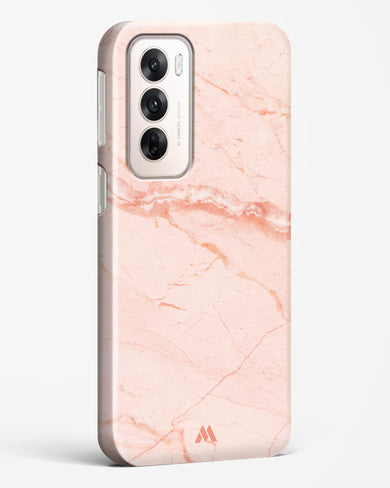 Rose Quartz on Marble Hard Case Phone Cover (Oppo)