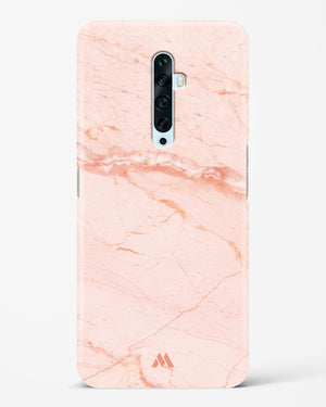 Rose Quartz on Marble Hard Case Phone Cover (Oppo)