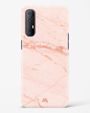 Rose Quartz on Marble Hard Case Phone Cover (Oppo)