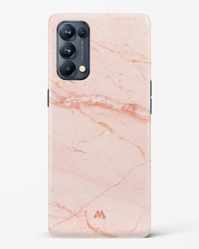 Rose Quartz on Marble Hard Case Phone Cover (Oppo)