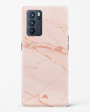 Rose Quartz on Marble Hard Case Phone Cover (Oppo)