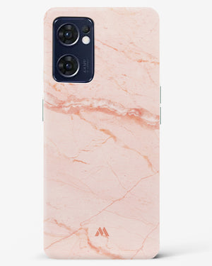 Rose Quartz on Marble Hard Case Phone Cover (Oppo)