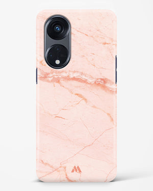 Rose Quartz on Marble Hard Case Phone Cover-(Oppo)