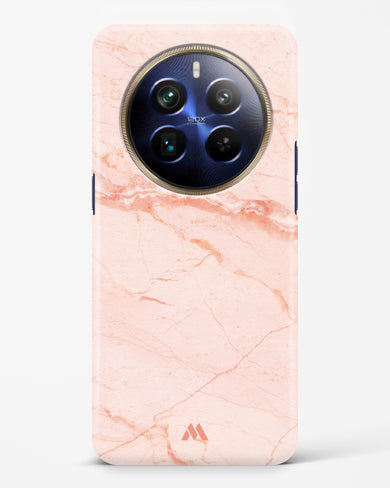 Rose Quartz on Marble Hard Case Phone Cover (Realme)