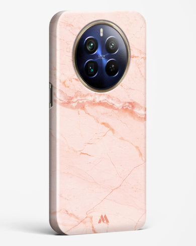 Rose Quartz on Marble Hard Case Phone Cover (Realme)