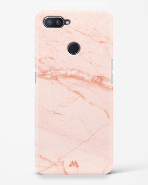 Rose Quartz on Marble Hard Case Phone Cover (Realme)