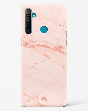 Rose Quartz on Marble Hard Case Phone Cover (Realme)