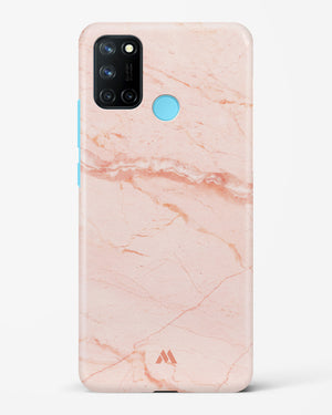Rose Quartz on Marble Hard Case Phone Cover (Realme)