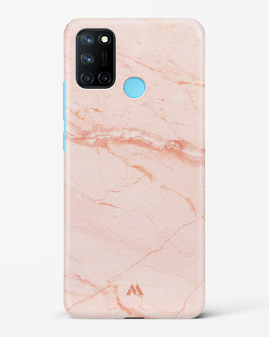 Rose Quartz on Marble Hard Case Phone Cover (Realme)