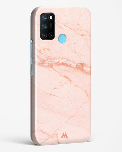 Rose Quartz on Marble Hard Case Phone Cover (Realme)