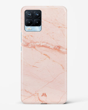 Rose Quartz on Marble Hard Case Phone Cover (Realme)