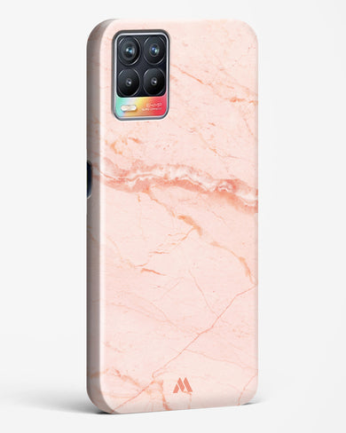 Rose Quartz on Marble Hard Case Phone Cover (Realme)