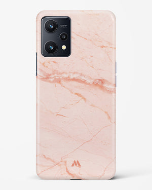Rose Quartz on Marble Hard Case Phone Cover (Realme)