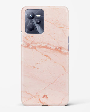 Rose Quartz on Marble Hard Case Phone Cover (Realme)