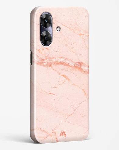 Rose Quartz on Marble Hard Case Phone Cover (Realme)