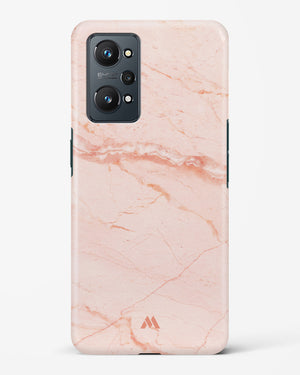 Rose Quartz on Marble Hard Case Phone Cover-(Realme)