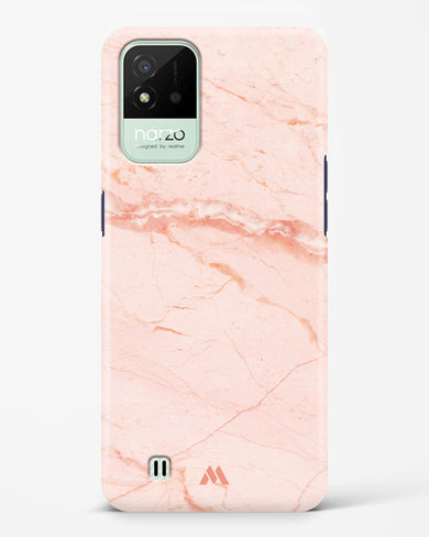 Rose Quartz on Marble Hard Case Phone Cover (Realme)
