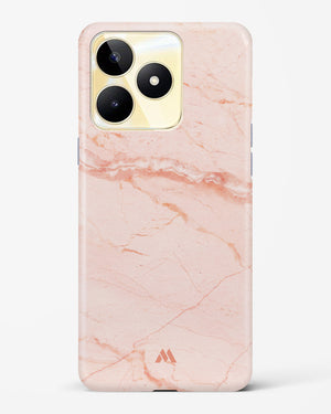Rose Quartz on Marble Hard Case Phone Cover (Realme)