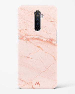 Rose Quartz on Marble Hard Case Phone Cover (Realme)